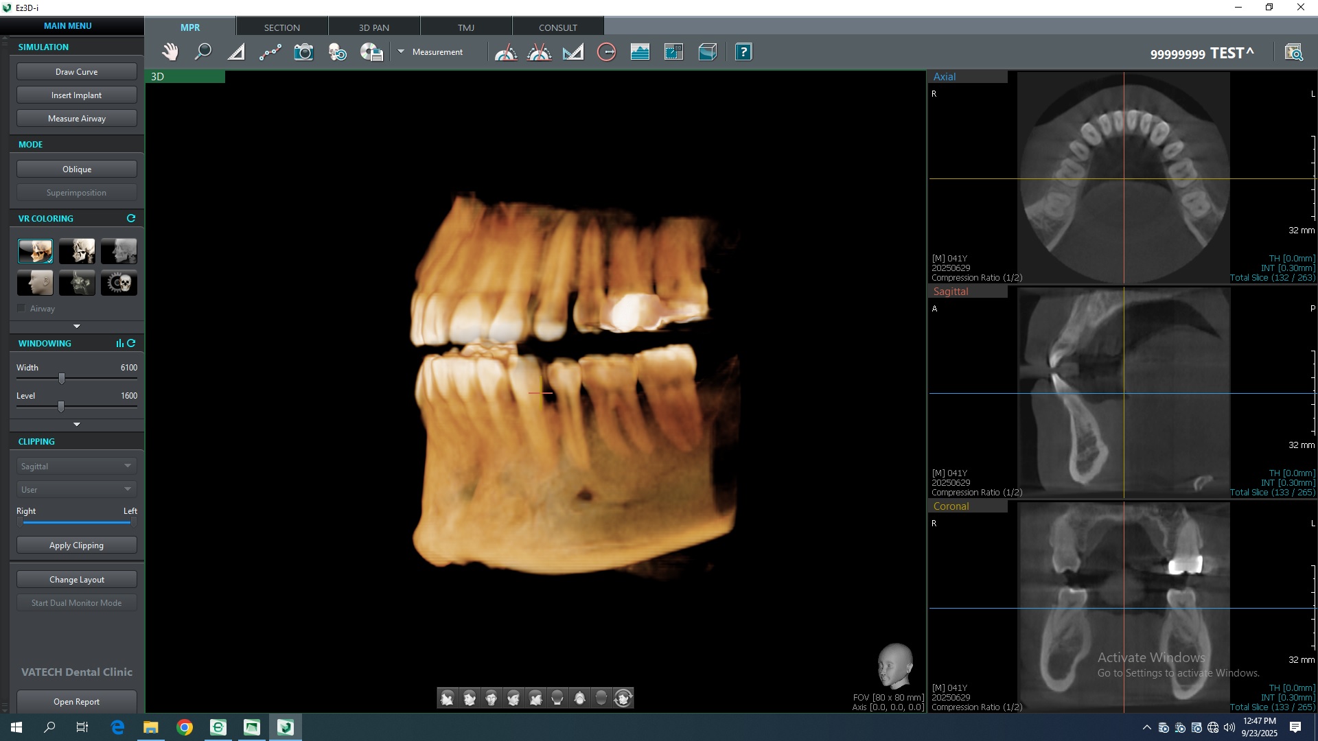 Ortopantógrafo Digital 3D PaX-i3D