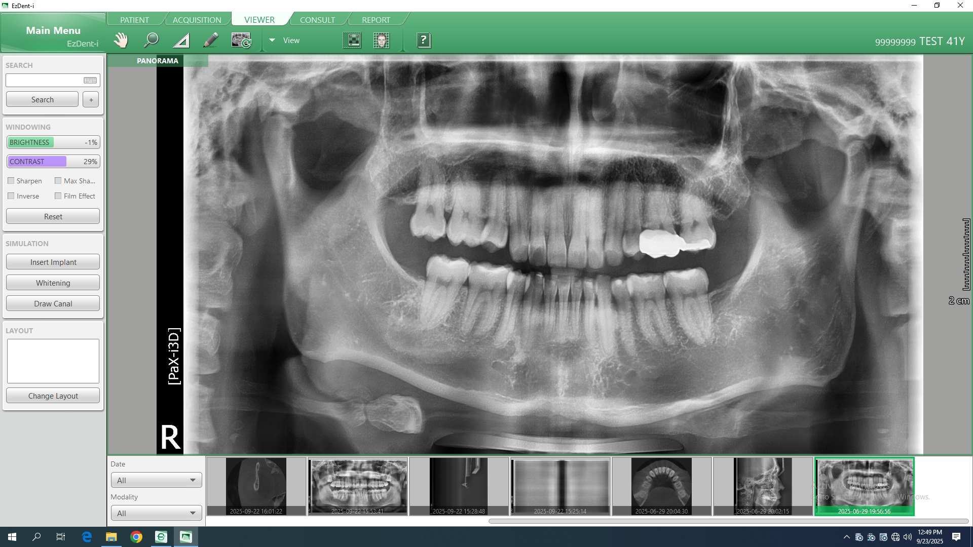 Ortopantógrafo Digital 3D PaX-i3D